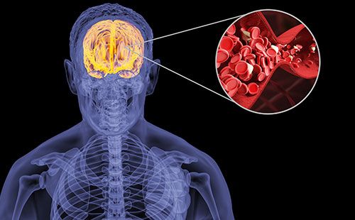 動(dòng)脈硬化檢測(cè)儀