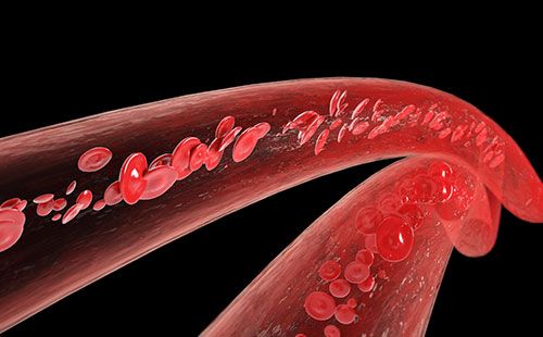 動(dòng)脈硬化檢測(cè)儀