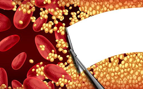 動(dòng)脈硬化檢測(cè)儀