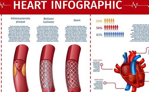 動(dòng)脈硬化檢測(cè)儀