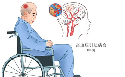 動脈硬化檢測儀