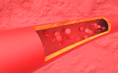 動(dòng)脈硬化檢測(cè)儀