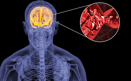 動(dòng)脈硬化檢測(cè)儀