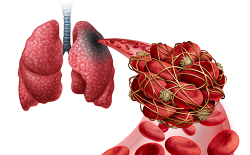 動脈硬化檢測儀