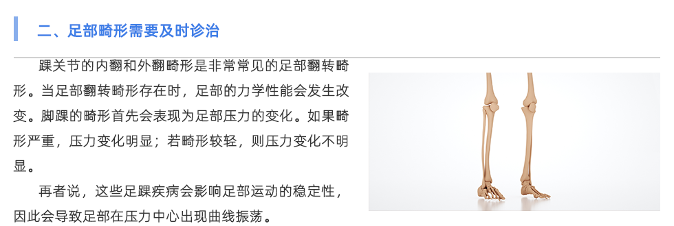 步態(tài)分析設備