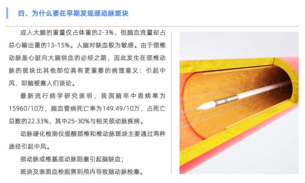 動脈硬化檢測儀