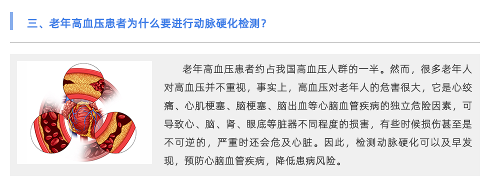 動(dòng)脈硬化檢測(cè)儀