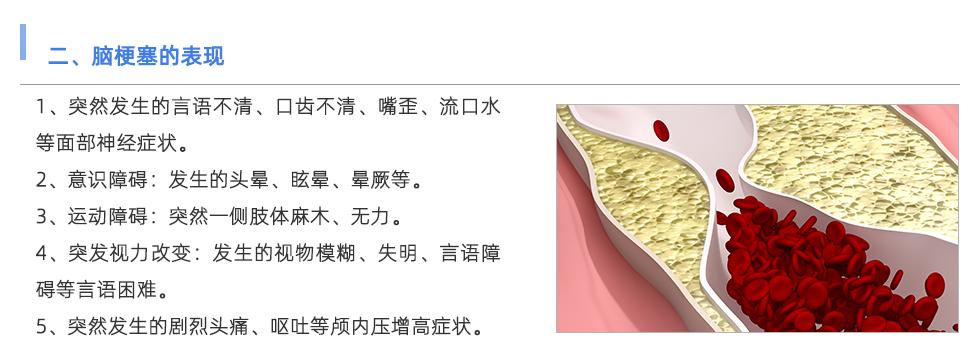 動(dòng)脈硬化檢測儀