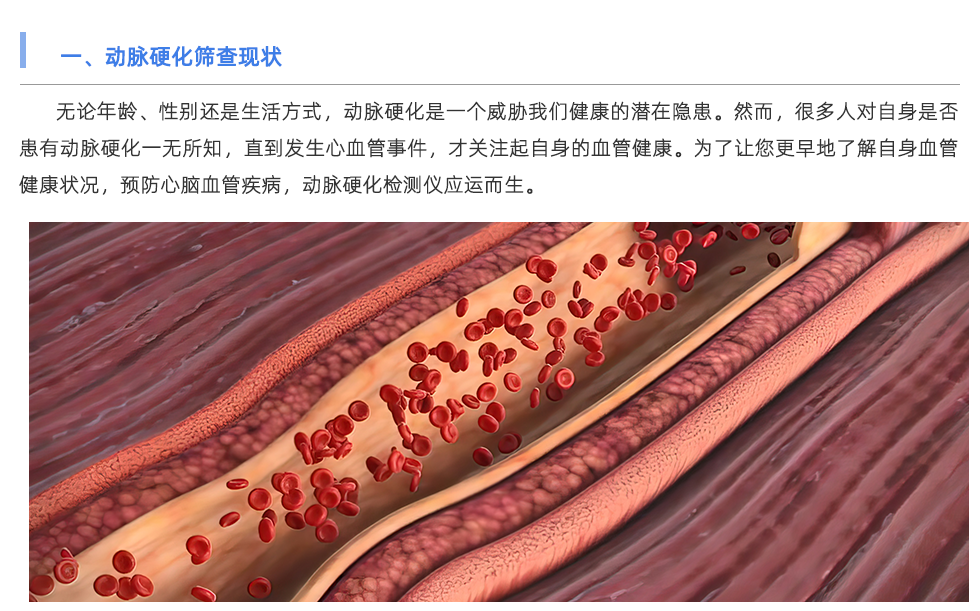 動(dòng)脈硬化檢測(cè)儀