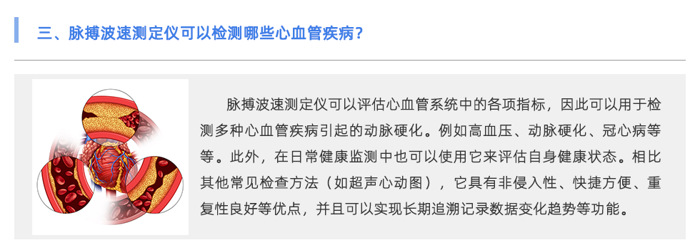 脈搏波速測定儀