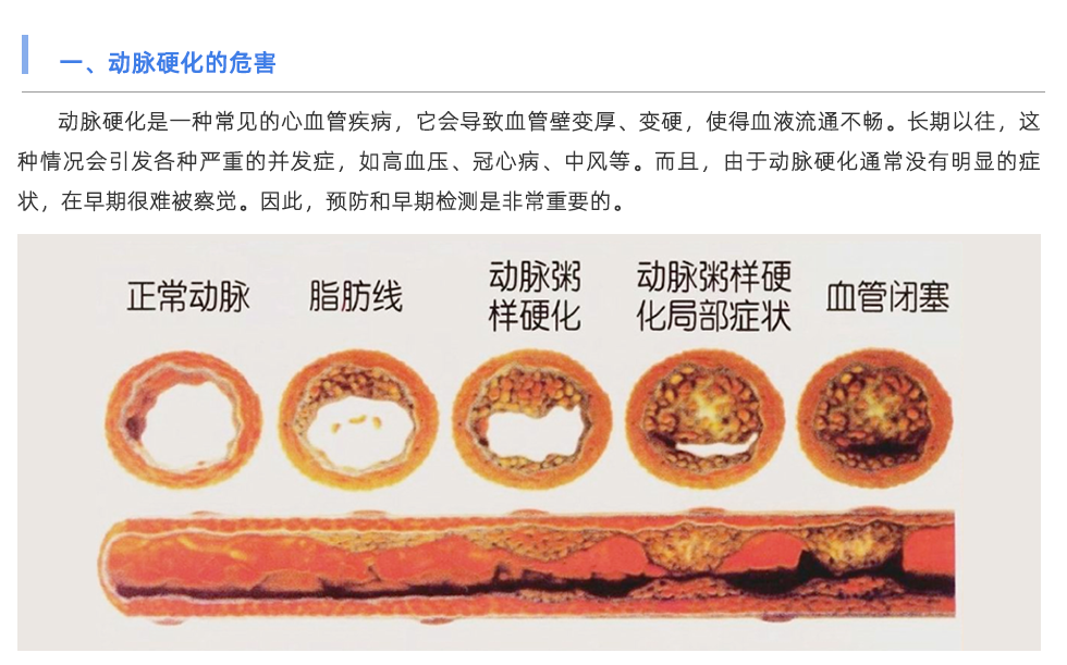 脈搏波速測(cè)定儀