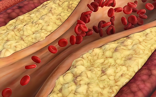 動(dòng)脈硬化檢測(cè)儀