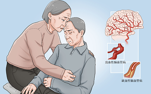 動脈硬化檢測儀