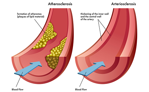 脈搏波速測(cè)定儀
